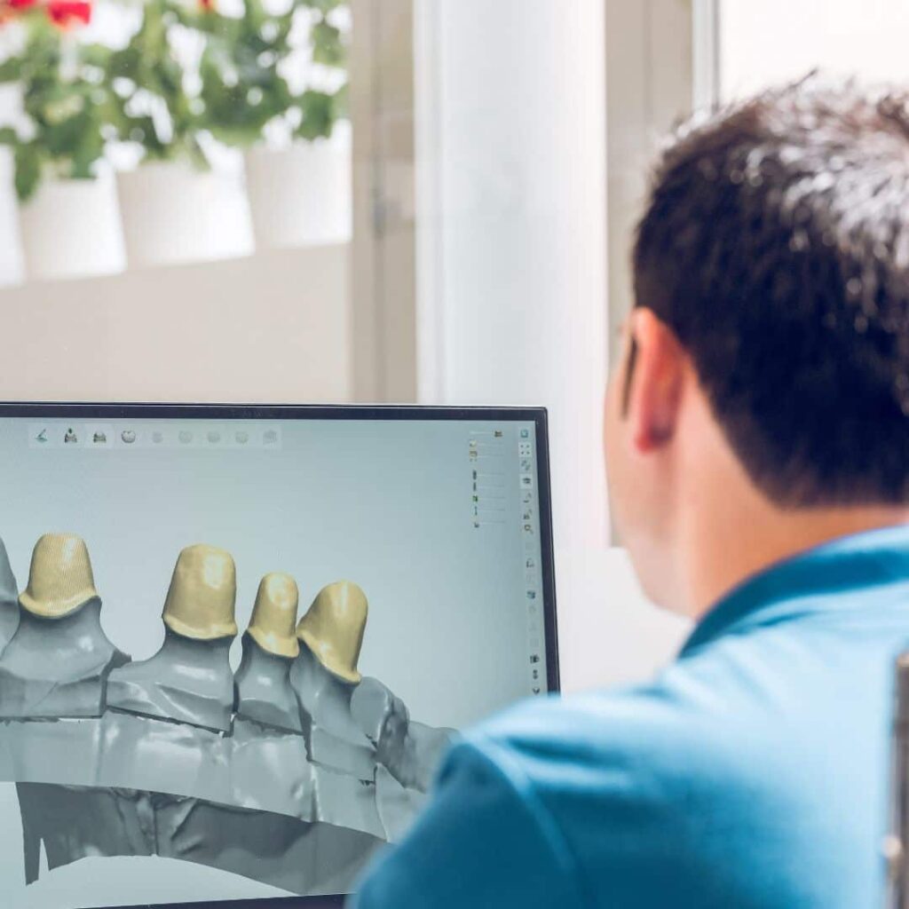 Implantes dentales guiada por ordenador